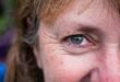 Reduce Your Unwanted Wrinkles