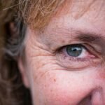 Reduce Your Unwanted Wrinkles