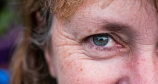 Reduce Your Unwanted Wrinkles