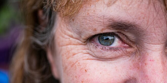 Reduce Your Unwanted Wrinkles