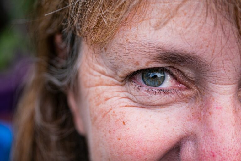 The Ultimate Guide to Wrinkle Reduction: Proven Strategies for Younger-Looking Skin